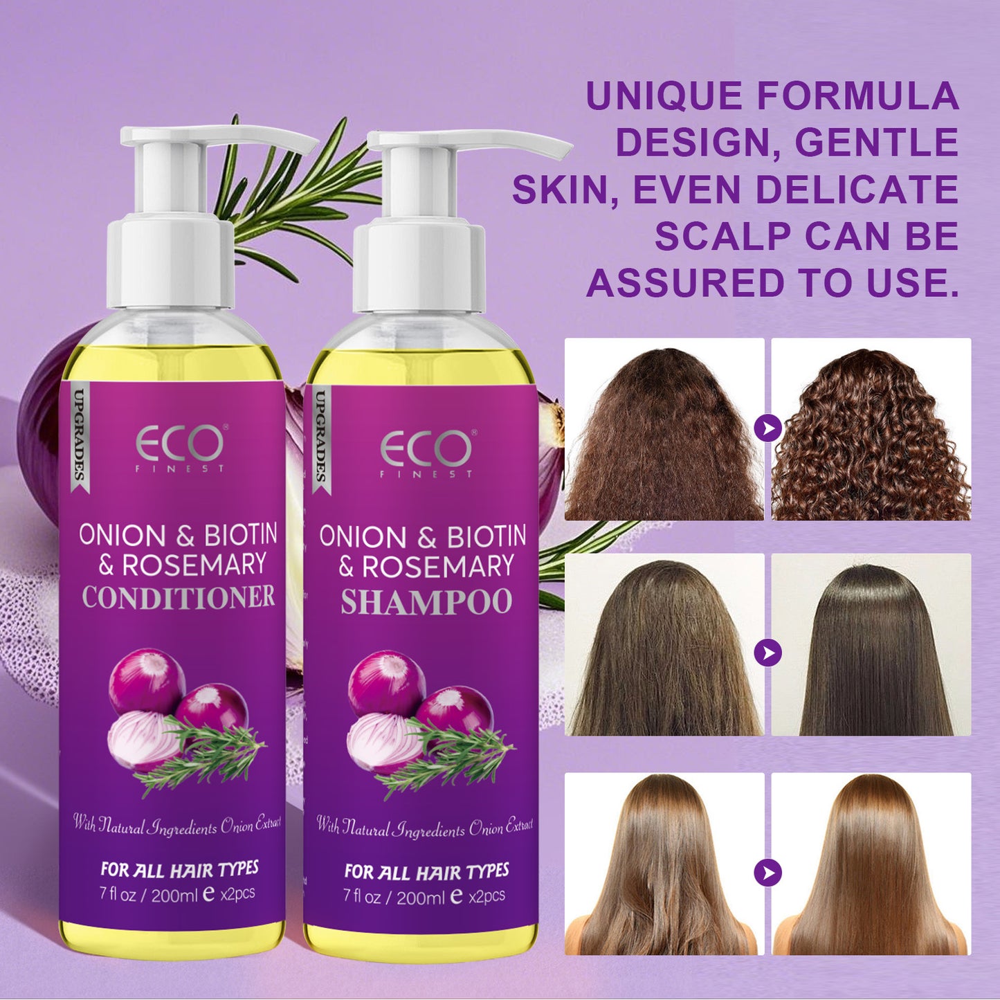 200ml x 2 Onion & Rosemary Shampoo & Conditioner Set – Natural Hair Growth Formula with Biotin, for Stronger, Thicker Hair and Scalp Care